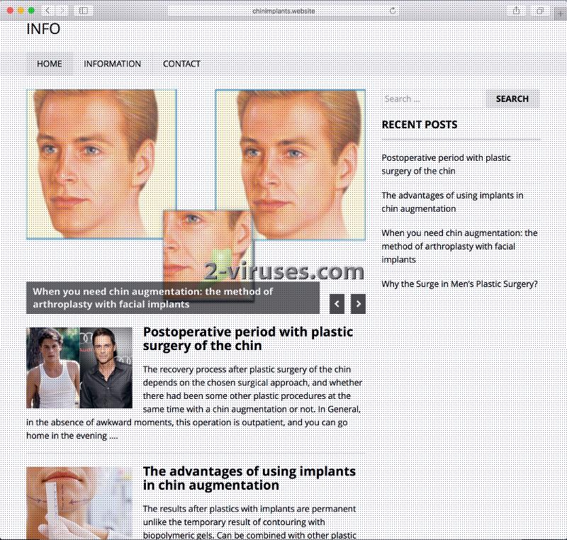chinimplants-website-2-2-viruses